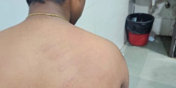 विद्यार्थ्यास मारहाण, पोलिसात गुन्हा दाखल