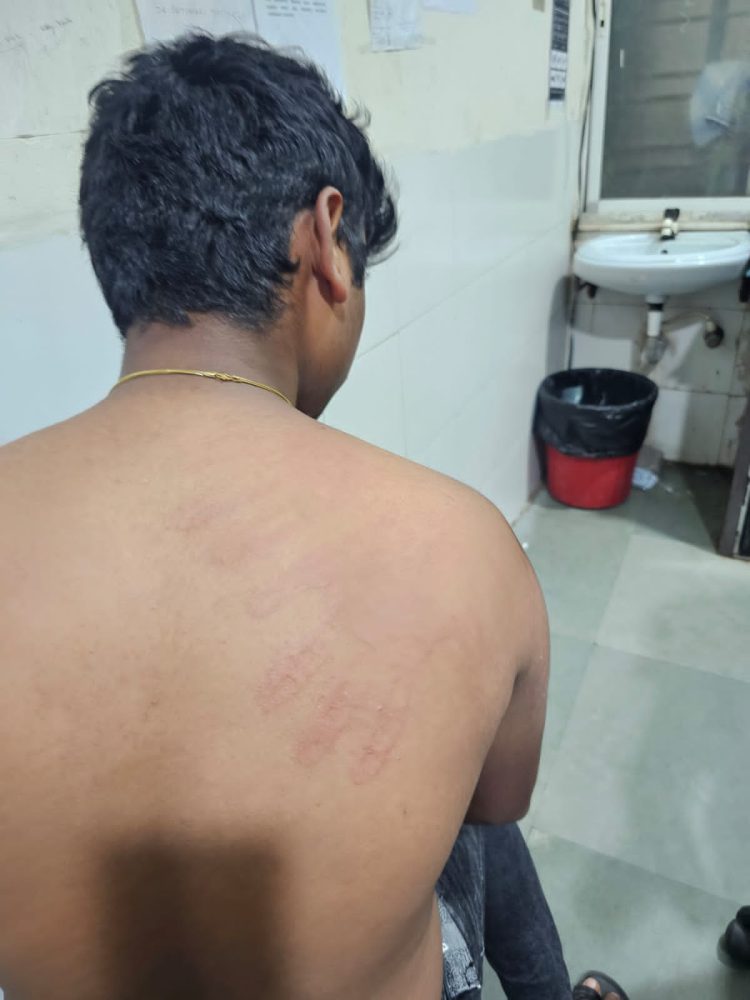 विद्यार्थ्यास मारहाण, पोलिसात गुन्हा दाखल